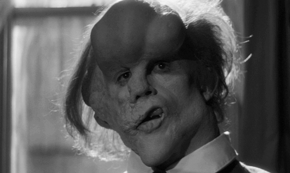 The Elephant Man: riflessione sulla dignità umana