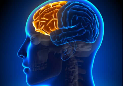 Sindrome disesecutiva o frontale