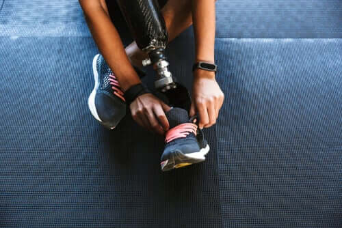 Sindrome dell'arto fantasma