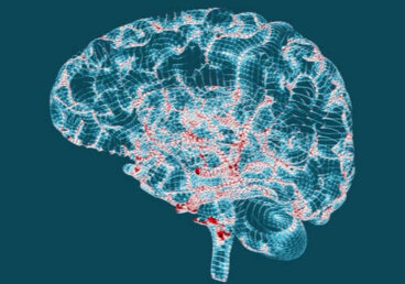 Malattia di Huntington: cause e sintomi