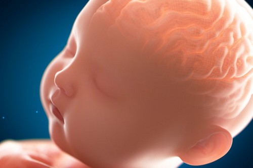 Pachigiria: il cervello liscio