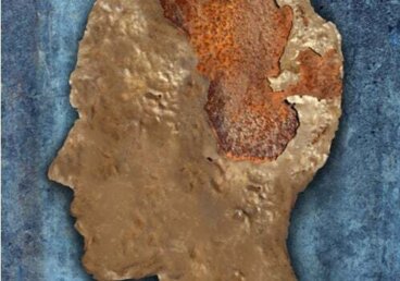 Encefalopatia spongiforme (la mucca pazza)