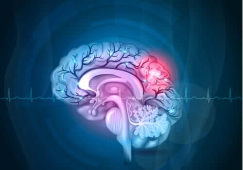 Effetto chemo brain: di cosa si tratta?